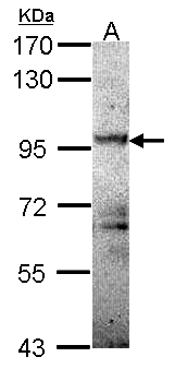 PRKD1 / PKC Mu Antibody - Sample (30 ug of whole cell lysate). A: Molt-4 . 7.5% SDS PAGE. PKD2 antibody diluted at 1:1000.