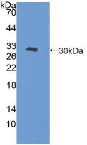 PRKD1 / PKC Mu Antibody - Western Blot; Sample: Recombinant PKD1, Human.