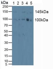 PRKD1 / PKC Mu Antibody - Western Blot; Sample: Lane1: Human Hela Cells; Lane2: Human Jurkat Cells; Lane3: Human HepG2 Cells; Lane4: Human U2OS Cells; Lane5: Human A549 Cells.