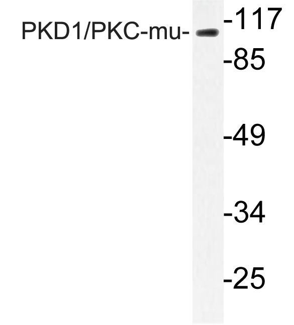 PRKD1 / PKC Mu Antibody - Western blot analysis of lysate from NIH/3T3 cells, using PKD1/PKC-mu antibody.