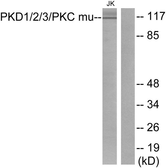 PRKD1 / PKC Mu Antibody - Western blot analysis of lysates from Jurkat cells, using PKD1/2/3/PKC mu Antibody. The lane on the right is blocked with the synthesized peptide.