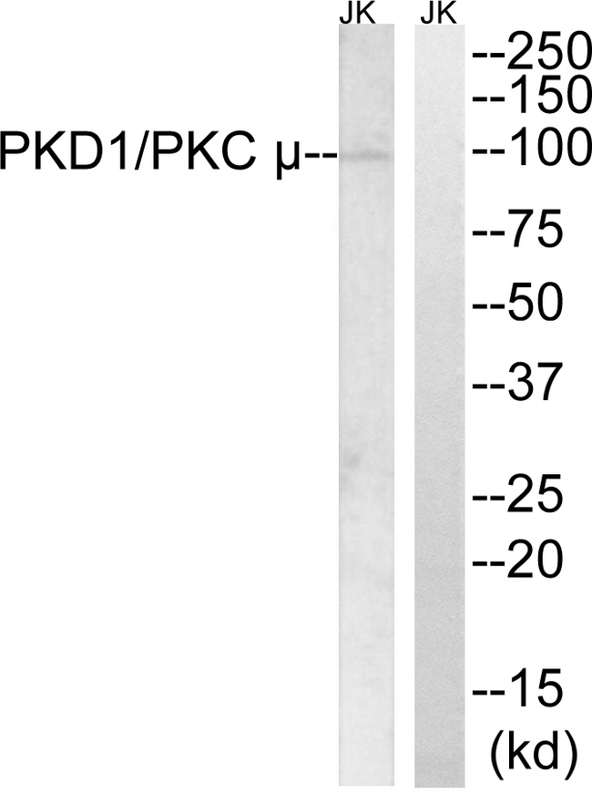 PRKD1 / PKC Mu Antibody - Western blot analysis of lysates from Jurkat cells, using PKD1/PKC mu Antibody. The lane on the right is blocked with the synthesized peptide.