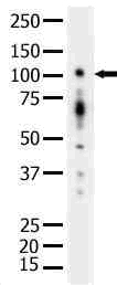 PRKD1 / PKC Mu Antibody - Western blot of PKD1/PKC (G459) pAb in extracts from HepG2 cells.