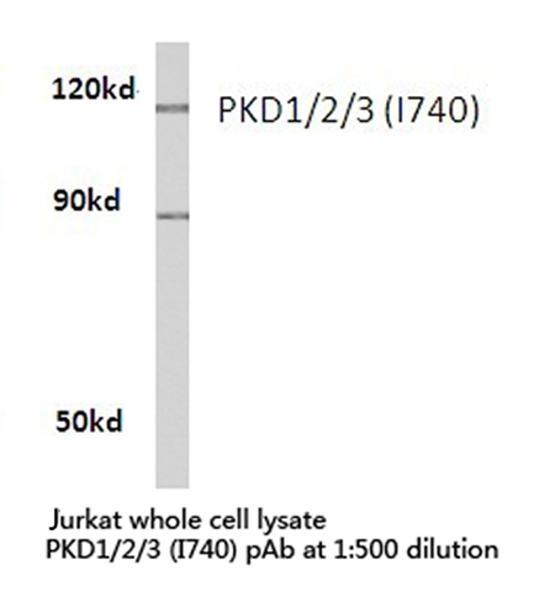 PRKD1 / PKC Mu Antibody - Western blot of PKD1/2/3/PKC (I740) pAb in extracts from Jurkat cells.