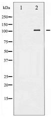 PRKD1 / PKC Mu Antibody - Western blot of PKD1/PKC mu expression in HepG2 whole cell lysates,The lane on the left is treated with the antigen-specific peptide.