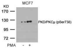 PRKD1 / PKC Mu Antibody - Detection of PKD/PKCµ in methanol-fixed HeLa cells.