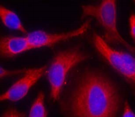 PRKD1 / PKC Mu Antibody - Detection of PKD/PKCµ in methanol-fixed HeLa cells.