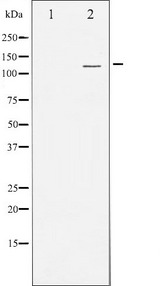 PRKD1 / PKC Mu Antibody - Western blot analysis of PKD1/2/3/PKC µ expression in Jurkat whole cells lysates. The lane on the left is treated with the antigen-specific peptide.