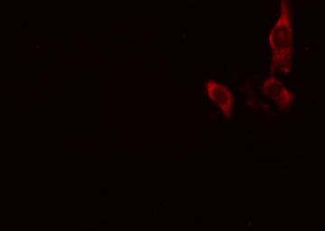 PRKD1 / PKC Mu Antibody - Staining A549 cells by IF/ICC. The samples were fixed with PFA and permeabilized in 0.1% Triton X-100, then blocked in 10% serum for 45 min at 25°C. The primary antibody was diluted at 1:200 and incubated with the sample for 1 hour at 37°C. An Alexa Fluor 594 conjugated goat anti-rabbit IgG (H+L) antibody, diluted at 1/600, was used as secondary antibody.