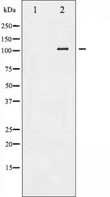 PRKD1 / PKC Mu Antibody - Western blot analysis of PKD1/PKC µ expression in HepG2 whole cells lysates. The lane on the left is treated with the antigen-specific peptide.