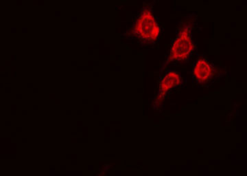 PRKD1 / PKC Mu Antibody - Staining A431 cells by IF/ICC. The samples were fixed with PFA and permeabilized in 0.1% Triton X-100, then blocked in 10% serum for 45 min at 25°C. The primary antibody was diluted at 1:200 and incubated with the sample for 1 hour at 37°C. An Alexa Fluor 594 conjugated goat anti-rabbit IgG (H+L) antibody, diluted at 1/600, was used as secondary antibody.