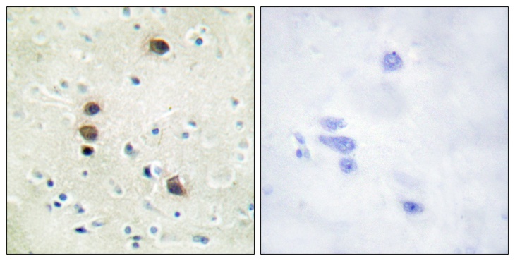 PRKD1 / PKC Mu Antibody - Immunohistochemistry analysis of paraffin-embedded human brain, using PKD1/PKC mu (Phospho-Ser205) Antibody. The picture on the right is blocked with the phospho peptide.