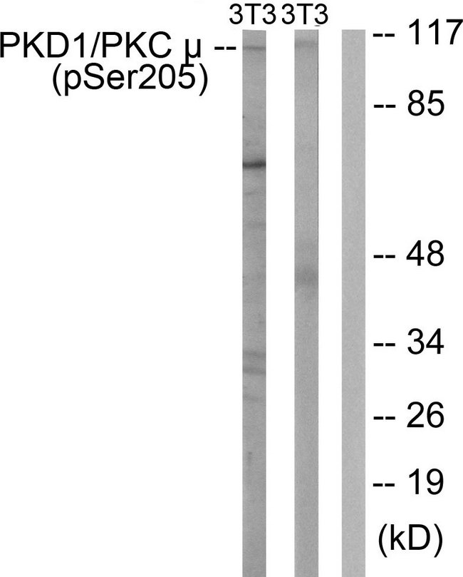 PRKD1 / PKC Mu Antibody - Western blot analysis of lysates from NIH/3T3 cells treated with Anisomycin 25ug/ml 30', using PKD1/PKC mu (Phospho-Ser205) Antibody. The lane on the right is blocked with the phospho peptide.