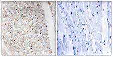 PRKD1 / PKC Mu Antibody - Immunohistochemistry analysis of paraffin-embedded human heart, using PKD1/2/3/PKC mu (Phospho-Ser738+Ser742) Antibody. The picture on the right is blocked with the phospho peptide.