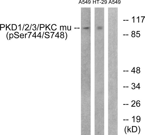 PRKD1 / PKC Mu Antibody - Western blot analysis of lysates from A549 cells treated with PMA 125ng/ml 30' and HT29 cells treated with serum 20% 15', using PKD1/2/3/PKC mu (Phospho-Ser738+Ser742) Antibody. The lane on the right is blocked with the phospho peptide.