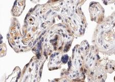 PRKD1 / PKC Mu Antibody - 1:100 staining human Placenta tissue by IHC-P. The tissue was formaldehyde fixed and a heat mediated antigen retrieval step in citrate buffer was performed. The tissue was then blocked and incubated with the antibody for 1.5 hours at 22°C. An HRP conjugated goat anti-rabbit antibody was used as the secondary.