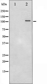PRKD1 / PKC Mu Antibody - Western blot analysis of PKD1/2/3/PKC µ phosphorylation expression in PMA treated A549 whole cells lysates. The lane on the left is treated with the antigen-specific peptide.