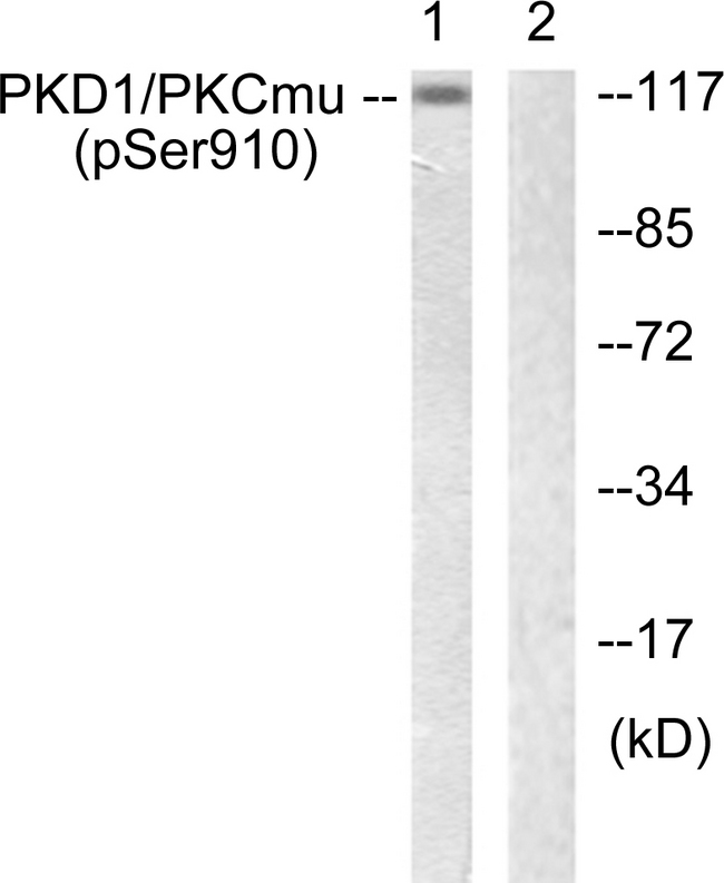 PRKD1 / PKC Mu Antibody - Western blot analysis of lysates from A431 cells, using PKD1/PKC mu (Phospho-Ser910) Antibody. The lane on the right is blocked with the phospho peptide.