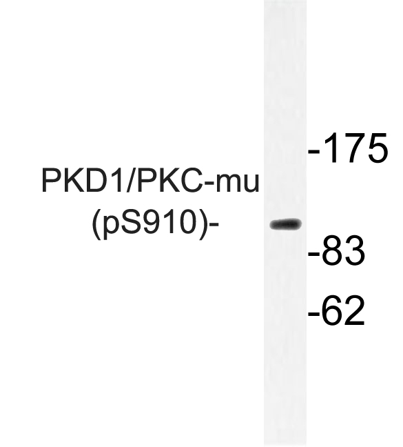 PRKD1 / PKC Mu Antibody - Western blot analysis of lysate from NIH/3T3 PDGF cells, using phospho-PKD1 and PKC-mu (Phospho-Ser910) antibody .