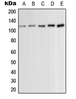 PRKD1 / PKC Mu Antibody - Western blot analysis of PKC mu (pS910) expression in HeLa (A); Jurkat (B); HEK293T PMA-treated (C); NIH3T3 PDGF-treated (D); H9C2 PMA-treated (E) whole cell lysates.