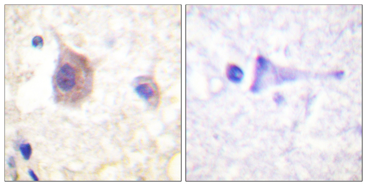 PRKD1 / PKC Mu Antibody - Immunohistochemistry analysis of paraffin-embedded human brain, using PKD1/PKC mu (Phospho-Tyr463) Antibody. The picture on the right is blocked with the phospho peptide.