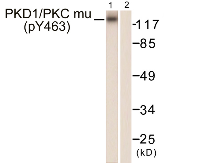 PRKD1 / PKC Mu Antibody - Western blot analysis of lysates from HepG2 cells, using PKD1/PKC mu (Phospho-Tyr463) Antibody. The lane on the right is blocked with the phospho peptide.