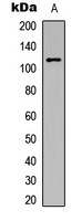 PRKD1 / PKC Mu Antibody - Western blot analysis of PKC mu (pY463) expression in HeLa (A) whole cell lysates.