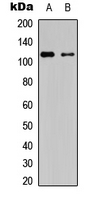PRKD1 + PRKD2 + PRKD3 Antibody - Western blot analysis of PRKD1/2/3 (pS738/S742) expression in HT29 (A); rat astrocytes (B) whole cell lysates.