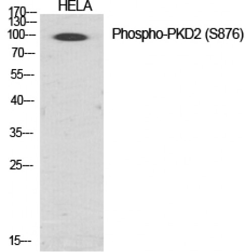 PRKD2 / PKD2 Antibody - Western blot of Phospho-PKD2 (S876) antibody