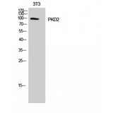 PRKD2 / PKD2 Antibody - Western blot of PKD2 antibody