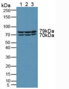 PRKD2 / PKD2 Antibody - Western Blot; Sample: Lane1: Rat Brain Tissue; Lane2: Human Hela Cells; Lane3: Human 293T Cells.