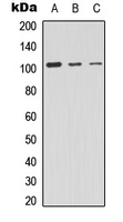 PRKD2 / PKD2 Antibody - Western blot analysis of PRKD2 expression in HEK293T (A); HeLa (B); NIH3T3 (C) whole cell lysates.