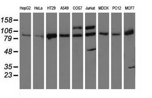 PRKD2 / PKD2 Antibody - Western blot of extracts (35 ug) from 9 different cell lines by using anti-PRKD2 monoclonal antibody.