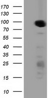 PRKD2 / PKD2 Antibody - HEK293T cells were transfected with the pCMV6-ENTRY control (Left lane) or pCMV6-ENTRY PRKD2 (Right lane) cDNA for 48 hrs and lysed. Equivalent amounts of cell lysates (5 ug per lane) were separated by SDS-PAGE and immunoblotted with anti-PRKD2.