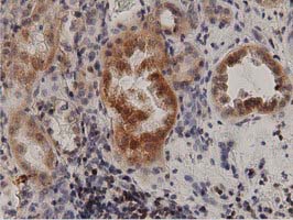 PRKD2 / PKD2 Antibody - Immunohistochemical staining of paraffin-embedded Human Kidney tissue using anti-PRKD2 mouse monoclonal antibody. (Dilution 1:50).