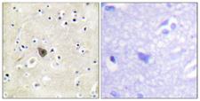 PRKD2 / PKD2 Antibody - Peptide - + Immunohistochemistry analysis of paraffin-embedded human brain tissue using PKD2 (Ab-876) antibody.