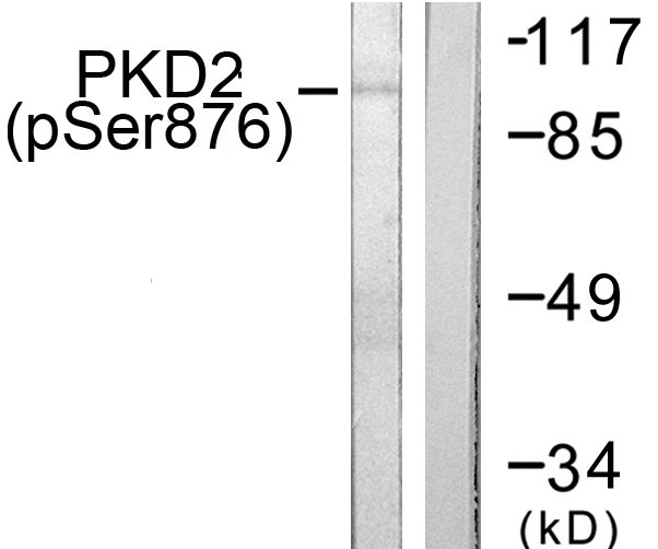 PRKD2 / PKD2 Antibody - Western blot analysis of lysates from NIH/3T3 cells treated with PMA 250ng/ml 15', using PKD2 (Phospho-Ser876) Antibody. The lane on the right is blocked with the phospho peptide.
