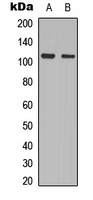 PRKD2 / PKD2 Antibody - Western blot analysis of PRKD2 (pS876) expression in HeLa (A); NIH3T3 (B) whole cell lysates.