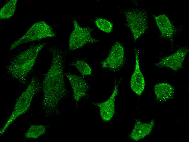 PRKD2 / PKD2 Antibody - Immunofluorescence staining of PRKD2 in Hela cells. Cells were fixed with 4% PFA, permeabilzed with 0.3% Triton X-100 in PBS, blocked with 10% serum, and incubated with rabbit anti-Human PRKD2 polyclonal antibody (dilution ratio 1:1000) at 4°C overnight. Then cells were stained with the Alexa Fluor 488-conjugated Goat Anti-rabbit IgG secondary antibody (green). Positive staining was localized to cytoplasm and nucleus.