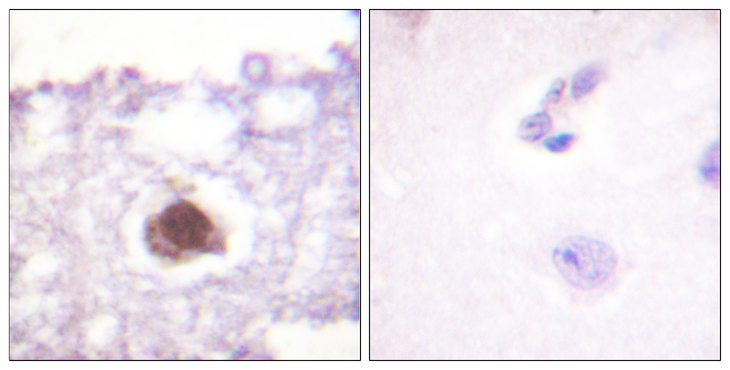 PRKDC / DNA-PKcs Antibody - Immunohistochemistry analysis of paraffin-embedded human brain tissue, using DNA-PK Antibody. The picture on the right is blocked with the synthesized peptide.