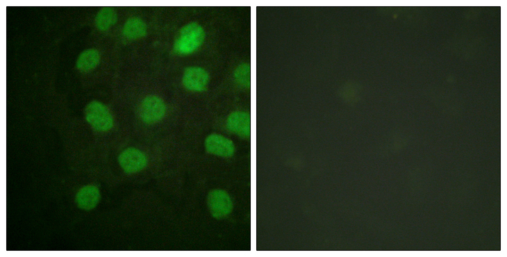 PRKDC / DNA-PKcs Antibody - Immunofluorescence analysis of HUVEC cells, using DNA-PK Antibody. The picture on the right is blocked with the synthesized peptide.