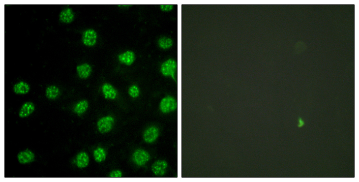 PRKDC / DNA-PKcs Antibody - Immunofluorescence analysis of HUVEC cells, using DNA-PK Antibody. The picture on the right is blocked with the synthesized peptide.