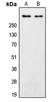 PRKDC / DNA-PKcs Antibody - Western blot analysis of DNA-PKcs expression in HeLa (A); MCF7 (B) whole cell lysates.