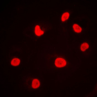 PRKDC / DNA-PKcs Antibody - Immunofluorescent analysis of DNA-PKcs staining in MCF7 cells. Formalin-fixed cells were permeabilized with 0.1% Triton X-100 in TBS for 5-10 minutes and blocked with 3% BSA-PBS for 30 minutes at room temperature. Cells were probed with the primary antibody in 3% BSA-PBS and incubated overnight at 4 C in a humidified chamber. Cells were washed with PBST and incubated with a DyLight 594-conjugated secondary antibody (red) in PBS at room temperature in the dark. DAPI was used to stain the cell nuclei (blue).
