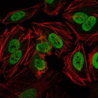 PRKDC / DNA-PKcs Antibody - Immunofluorescence of HeLa cells using PRKDC mouse monoclonal antibody (green). Red: Actin filaments have been labeled with Alexa Fluor-555 phalloidin.