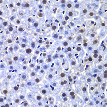 PRKDC / DNA-PKcs Antibody - Immunohistochemistry of paraffin-embedded mouse liver tissue.