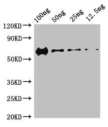PRKDC / DNA-PKcs Antibody - Western Blot Positive WB detected in Recombinant protein All lanes: PRKDC antibody at 3µg/ml Secondary Goat polyclonal to rabbit IgG at 1/50000 dilution predicted band size: 60 kDa observed band size: 60 kDa