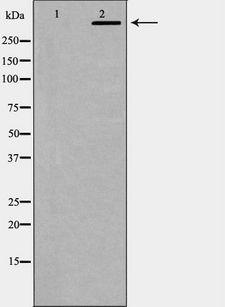 PRKDC / DNA-PKcs Antibody - Western blot analysis of DNA PK expression in K562 cells. The lane on the left is treated with the antigen-specific peptide.