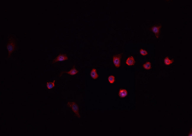 PRKDC / DNA-PKcs Antibody - Staining HeLa cells by IF/ICC. The samples were fixed with PFA and permeabilized in 0.1% Triton X-100, then blocked in 10% serum for 45 min at 25°C. The primary antibody was diluted at 1:200 and incubated with the sample for 1 hour at 37°C. An Alexa Fluor 594 conjugated goat anti-rabbit IgG (H+L) antibody, diluted at 1/600, was used as secondary antibody.