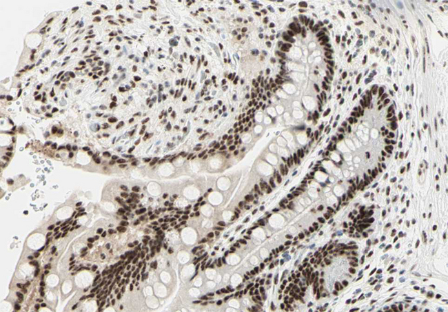 PRKDC / DNA-PKcs Antibody - 1:100 staining human colon tissue by IHC-P. The tissue was formaldehyde fixed and a heat mediated antigen retrieval step in citrate buffer was performed. The tissue was then blocked and incubated with the antibody for 1.5 hours at 22°C. An HRP conjugated goat anti-rabbit antibody was used as the secondary.